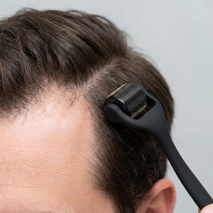 ScalpRoller™ Pro | 192 Titanium Needles