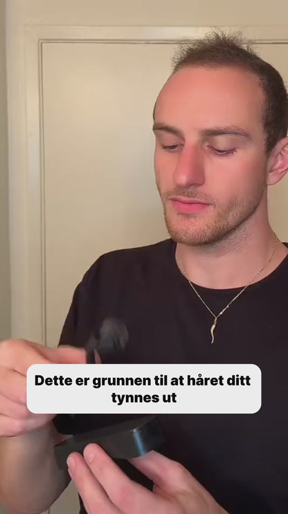 ScalpRoller™ Pro | 192 Titanium Needles